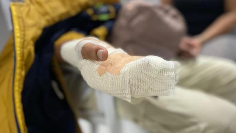 Primer quemado con pólvora en esta Navidad en Ibagué