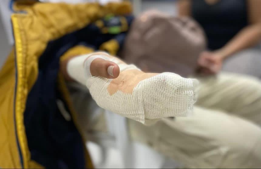 Primer quemado con pólvora en esta Navidad en Ibagué